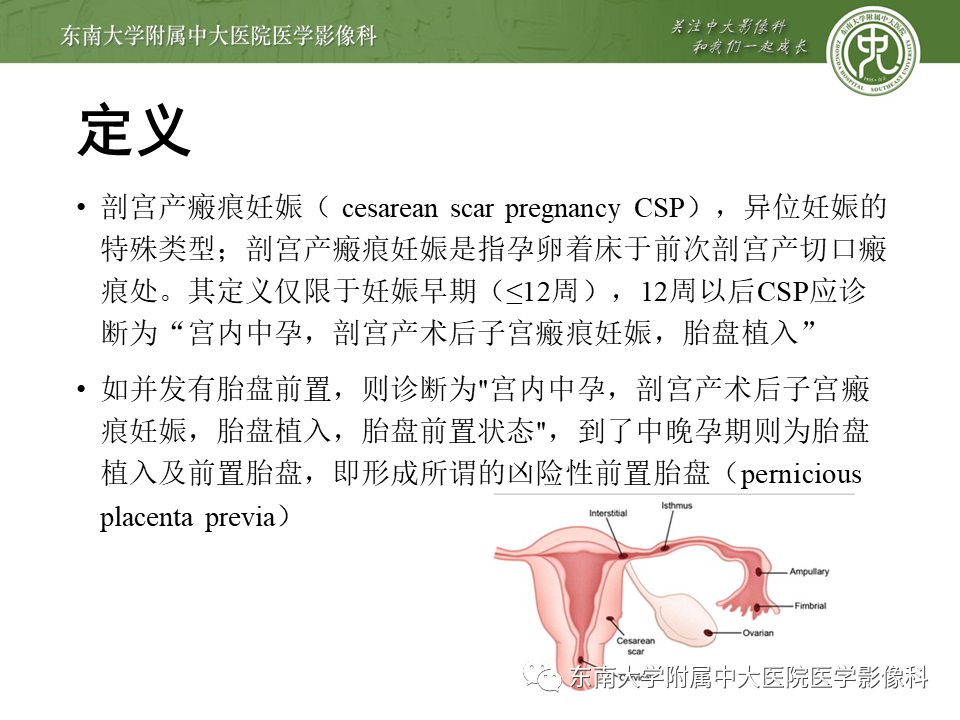 影像PPT - 【PPT】剖宫产瘢痕妊娠-2