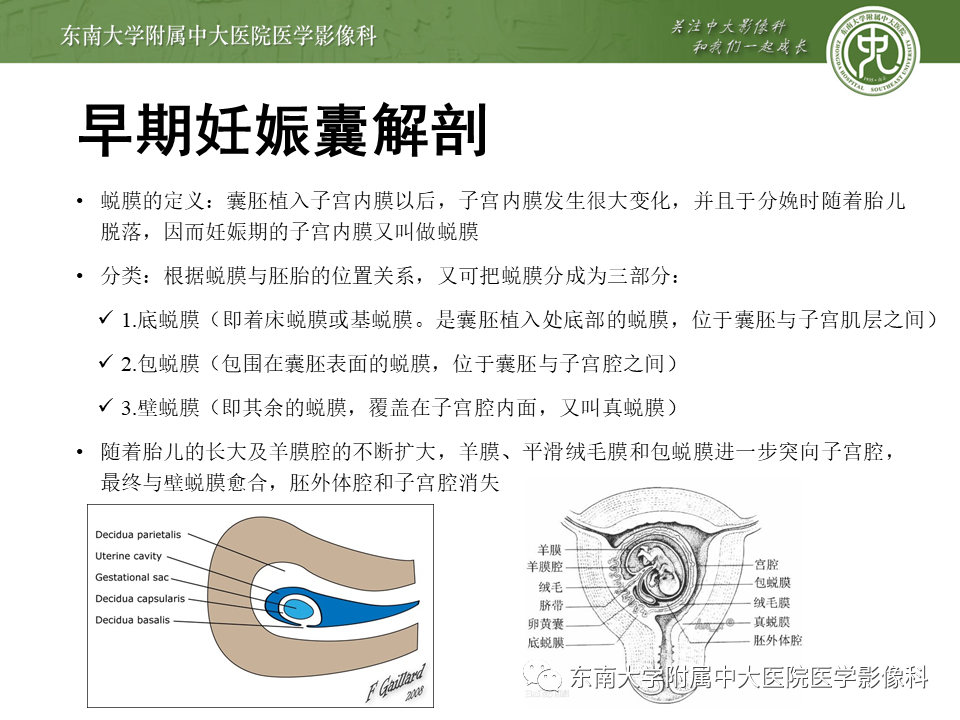 影像PPT - 【PPT】剖宫产瘢痕妊娠-5