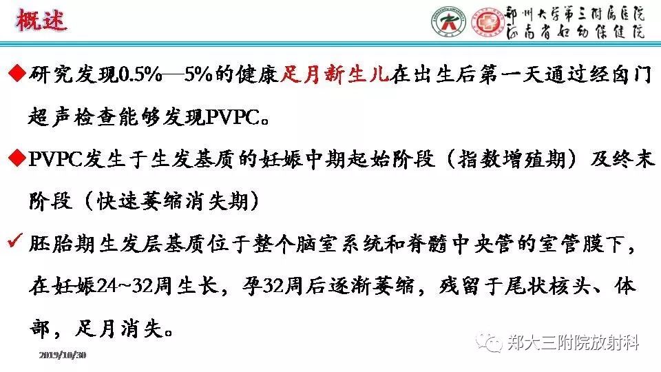 影像PPT - 【PPT】室周假性囊肿-3