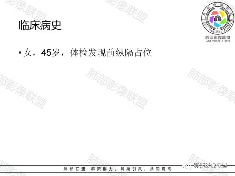 影像PPT - 【病例】前纵隔富血供占位—甲状腺癌1例CT鉴别诊断-1 影像PPT - 【病例】前纵隔富血供占位—甲状腺癌1例CT鉴别诊断-1