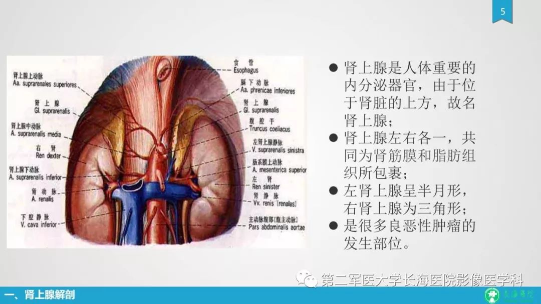 影像PPT - 【PPT】肾上腺肿物的分类及其影像学特点-5 影像PPT - 【PPT】肾上腺肿物的分类及其影像学特点-5