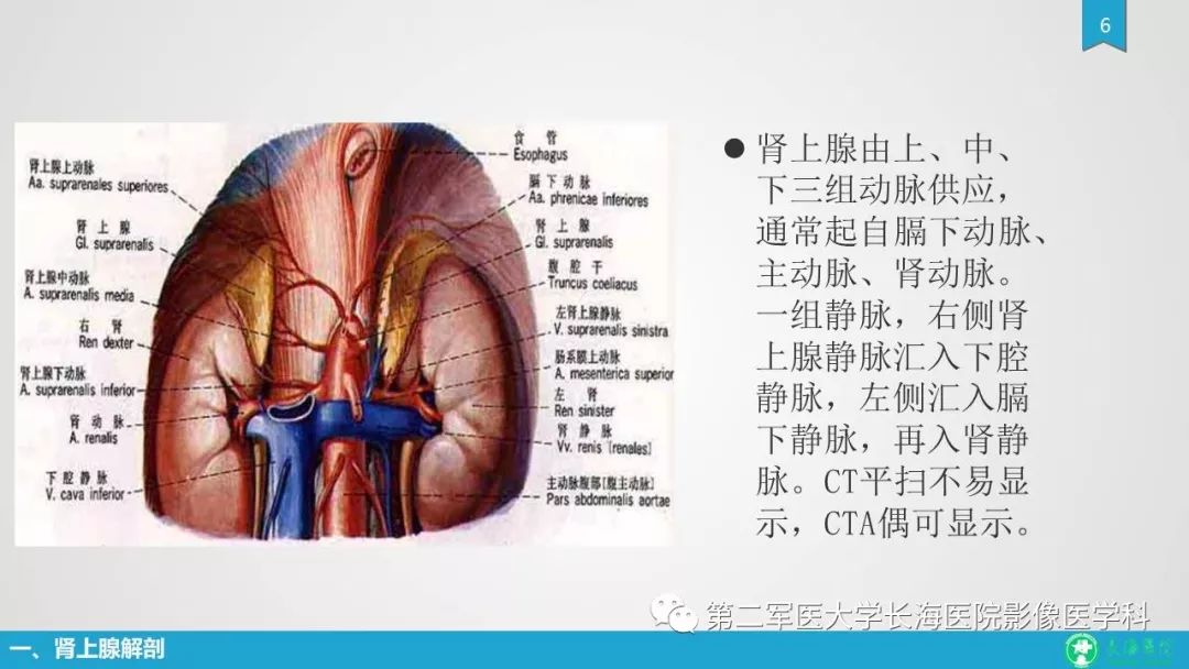 影像PPT - 【PPT】肾上腺肿物的分类及其影像学特点-6 影像PPT - 【PPT】肾上腺肿物的分类及其影像学特点-6
