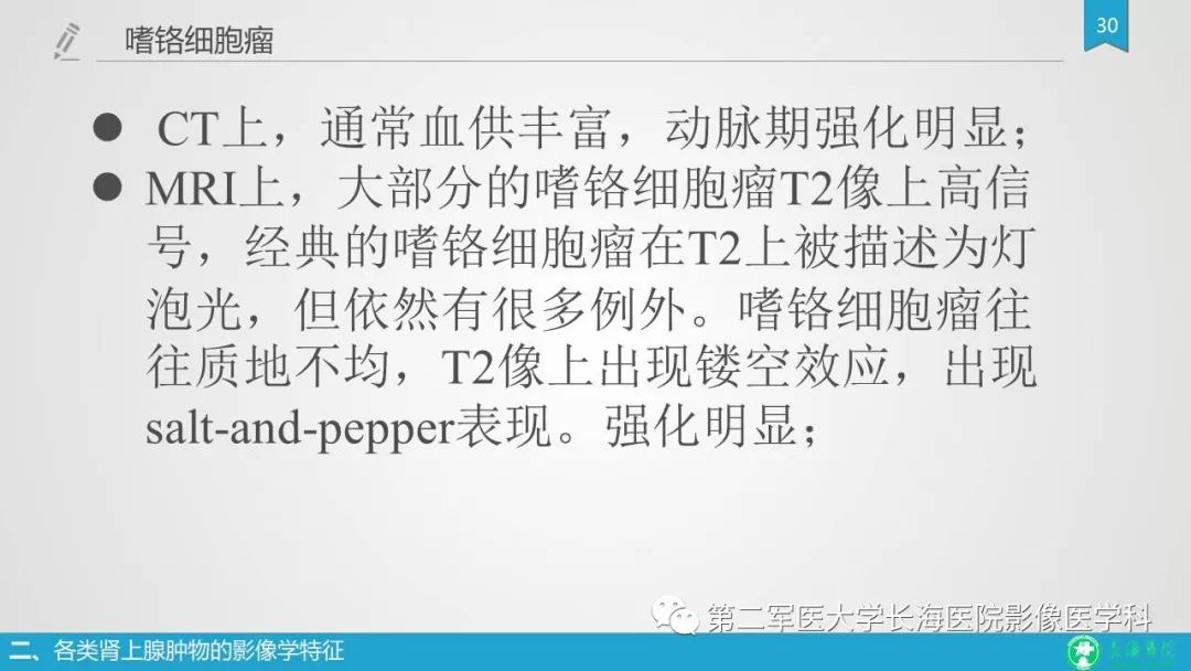 影像PPT - 【PPT】肾上腺肿物的分类及其影像学特点-30 影像PPT - 【PPT】肾上腺肿物的分类及其影像学特点-30