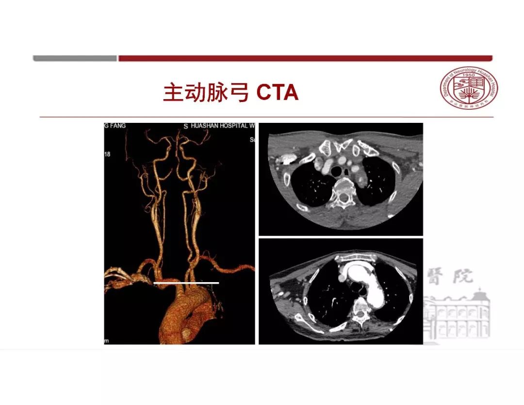 影像PPT - 【PPT】脑血管的解剖基础-5