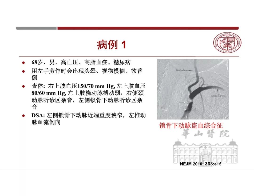 影像PPT - 【PPT】脑血管的解剖基础-6