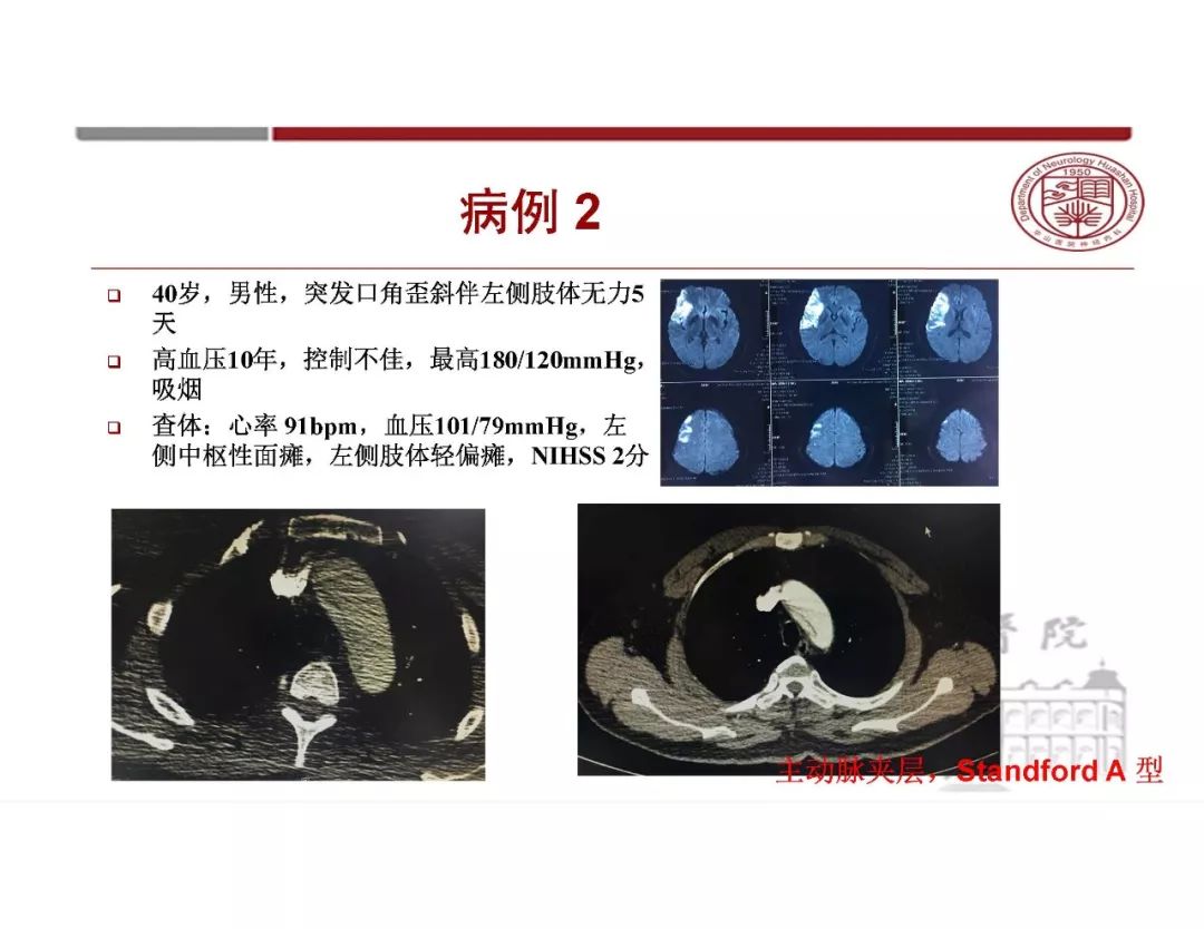 影像PPT - 【PPT】脑血管的解剖基础-7