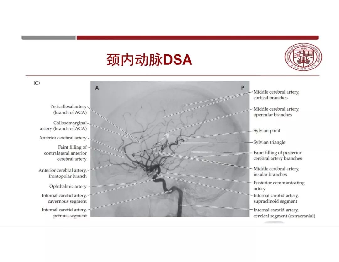 影像PPT - 【PPT】脑血管的解剖基础-9