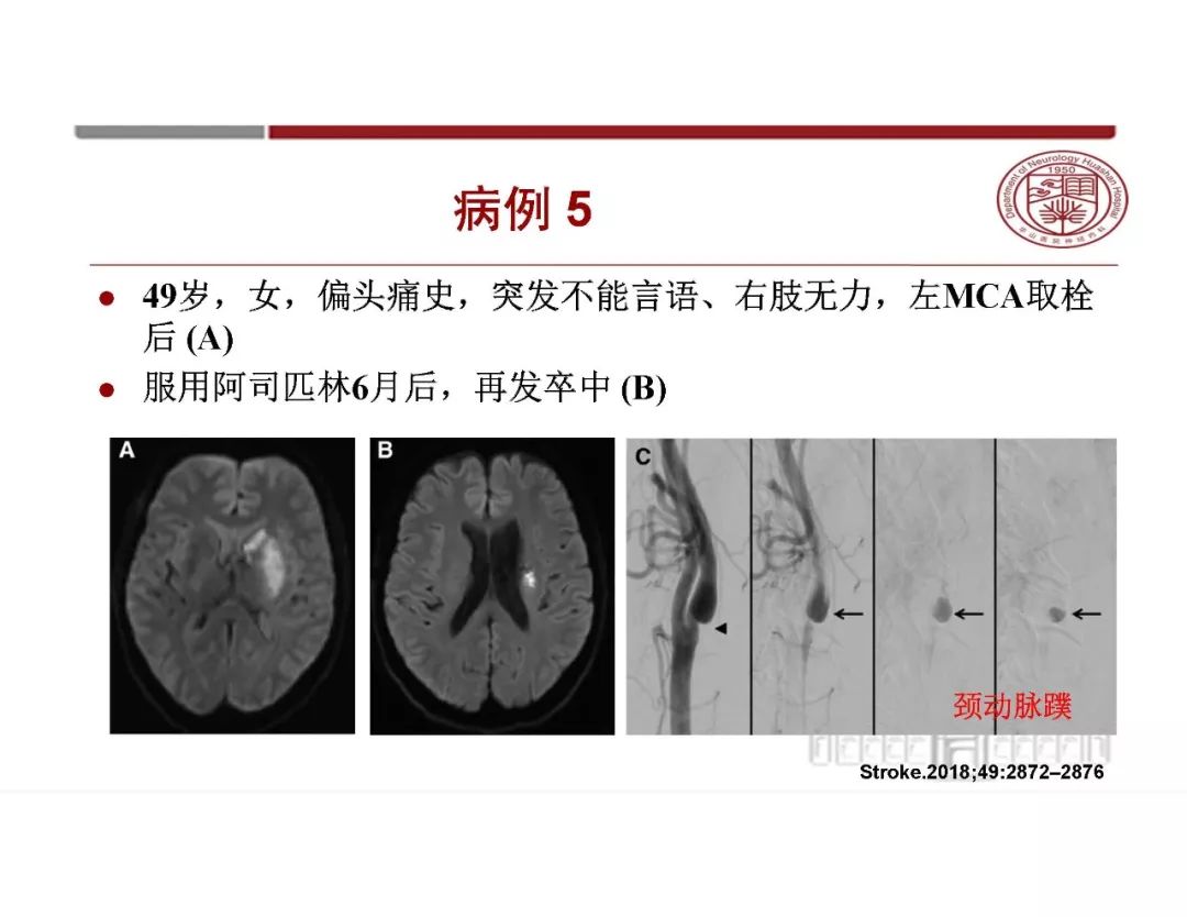 影像PPT - 【PPT】脑血管的解剖基础-13