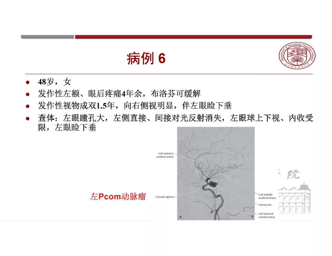 影像PPT - 【PPT】脑血管的解剖基础-14
