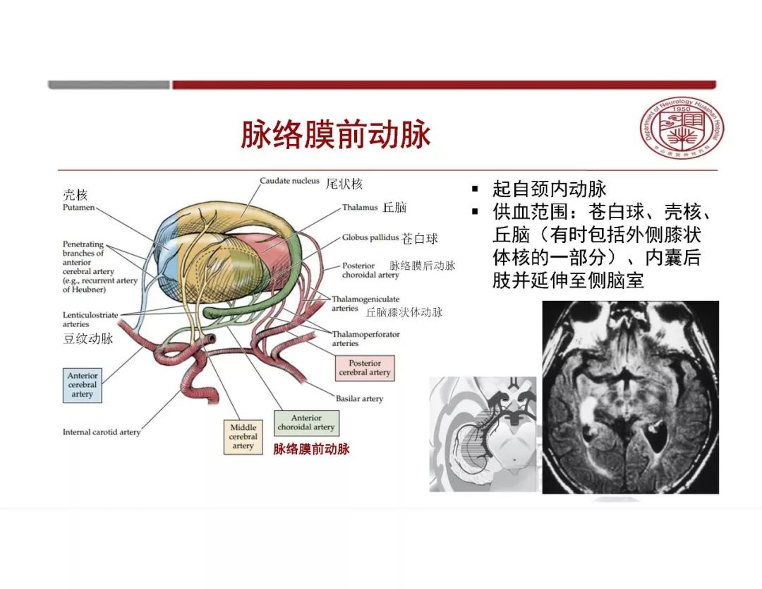 影像PPT - 【PPT】脑血管的解剖基础-15