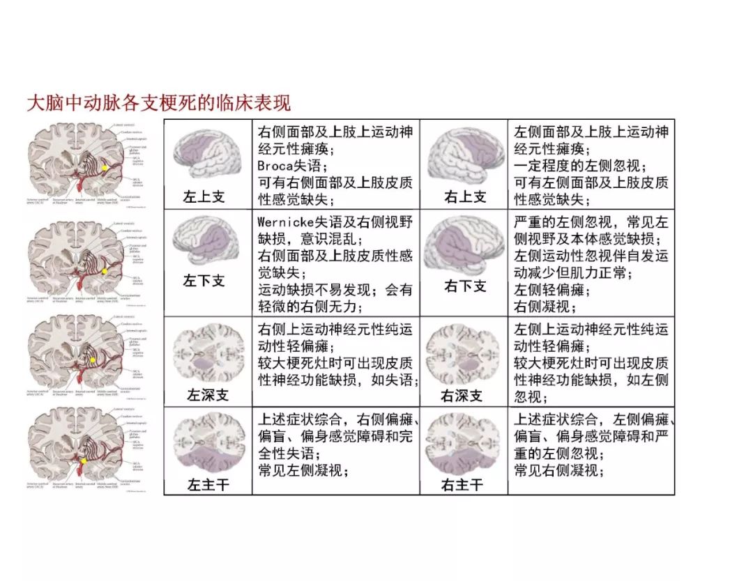 影像PPT - 【PPT】脑血管的解剖基础-22