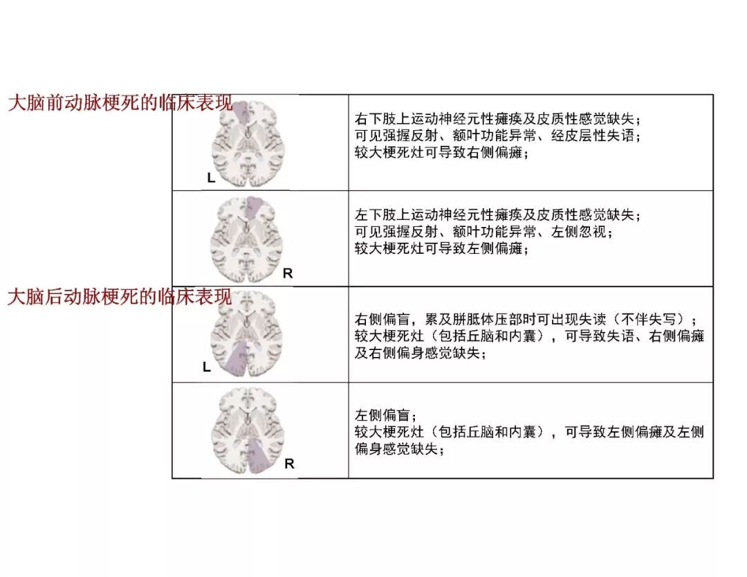 影像PPT - 【PPT】脑血管的解剖基础-23