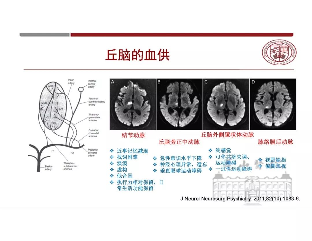 影像PPT - 【PPT】脑血管的解剖基础-25