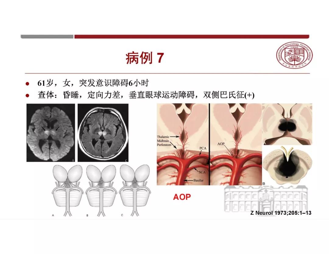 影像PPT - 【PPT】脑血管的解剖基础-26