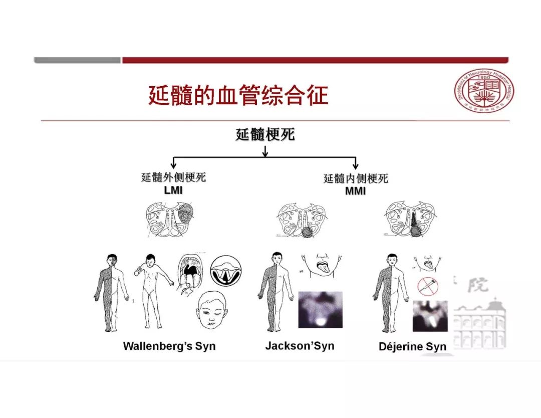影像PPT - 【PPT】脑血管的解剖基础-32