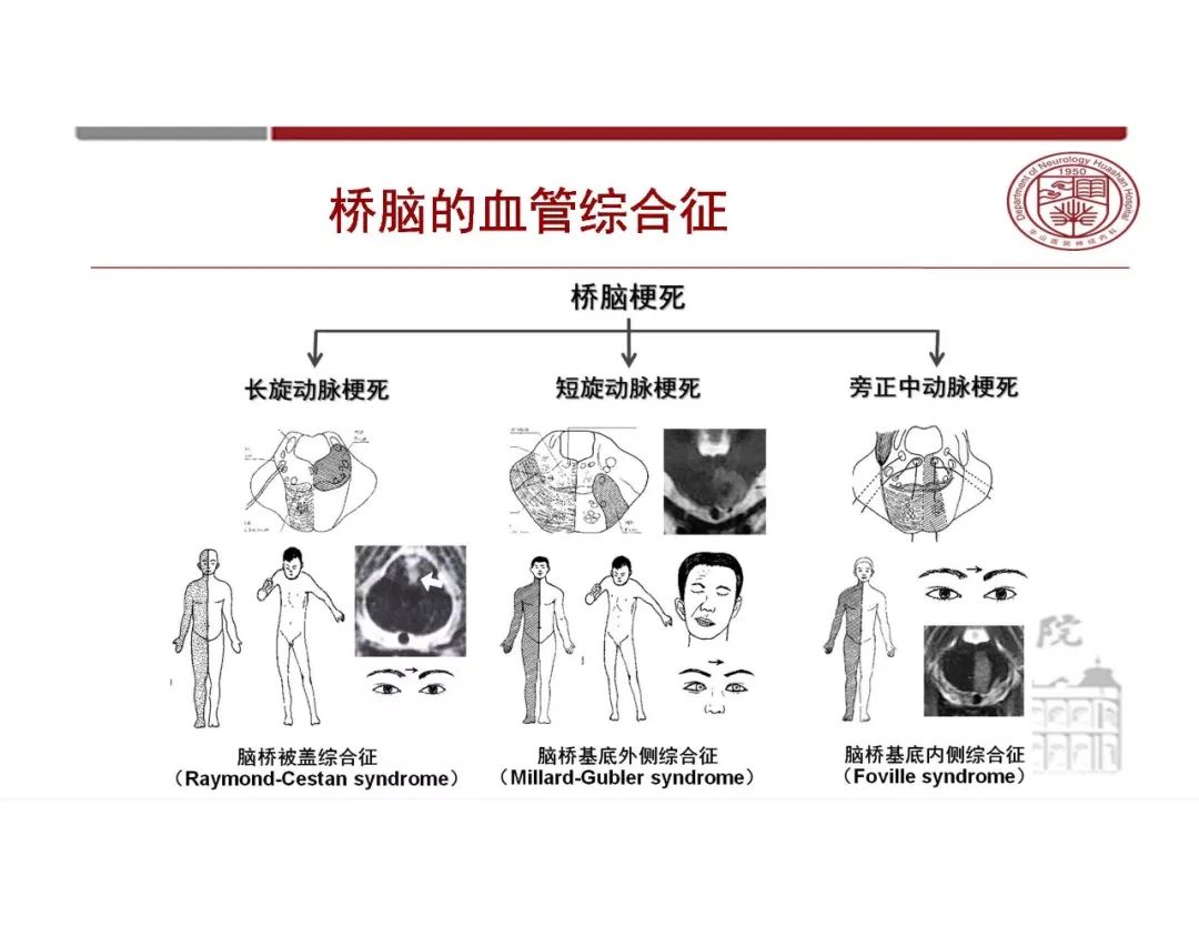 影像PPT - 【PPT】脑血管的解剖基础-36