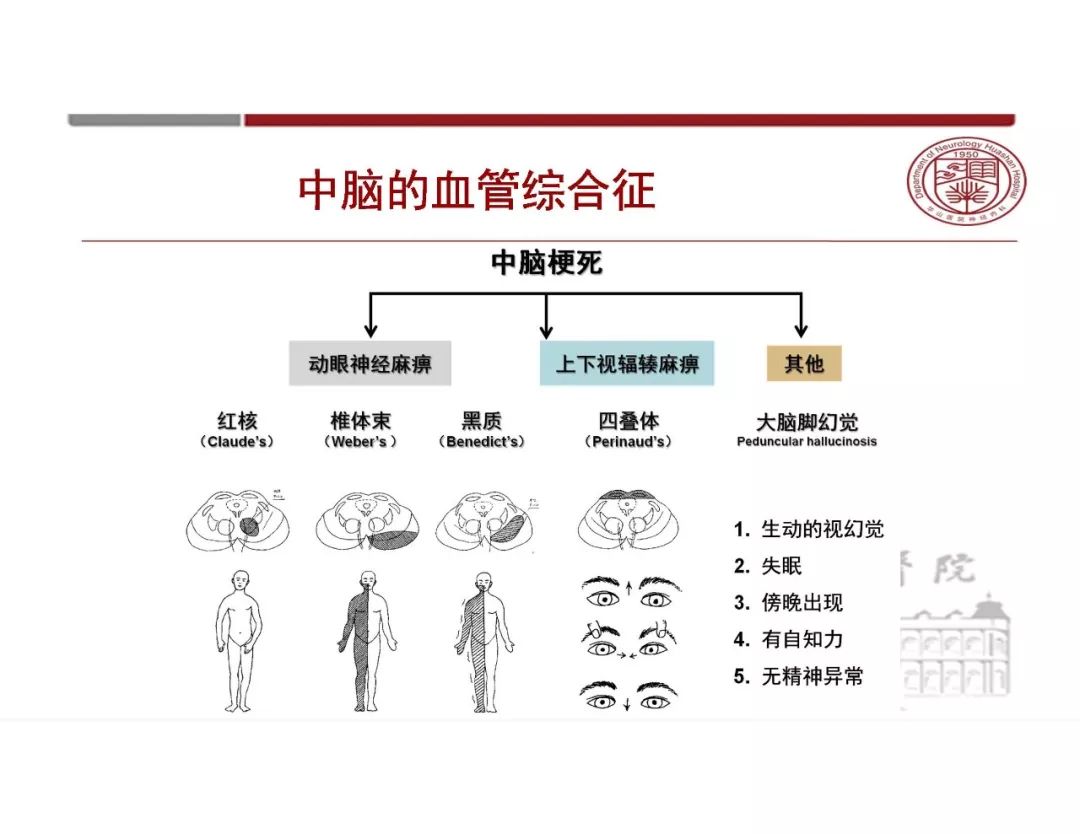 影像PPT - 【PPT】脑血管的解剖基础-38