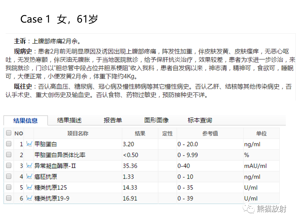 影像PPT - 【病例】IgG4相关硬化性胆管炎及肾炎2例-2