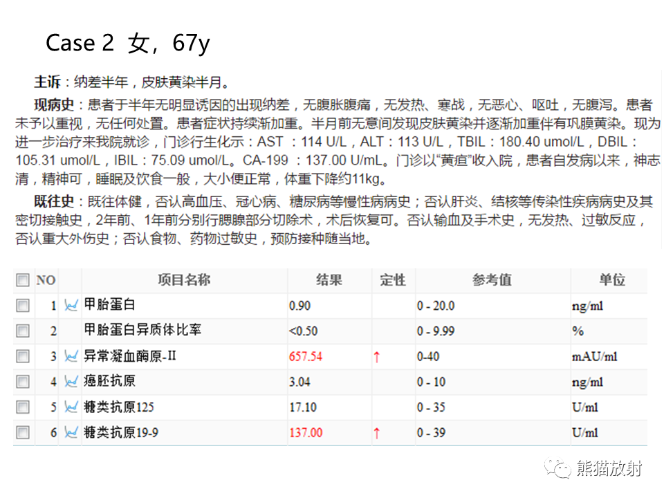 影像PPT - 【病例】IgG4相关硬化性胆管炎及肾炎2例-14