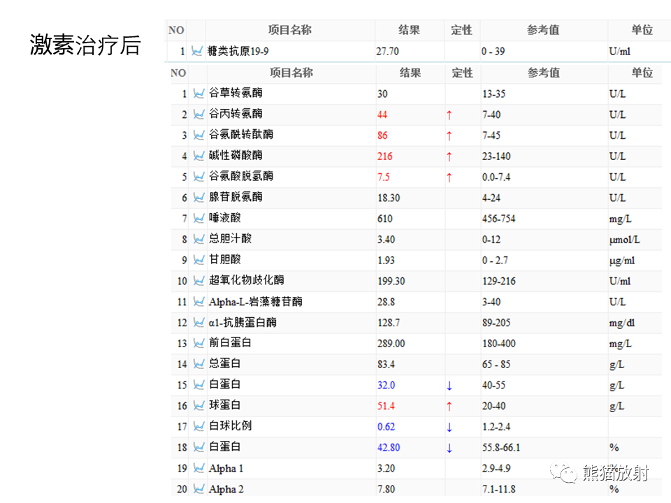 影像PPT - 【病例】IgG4相关硬化性胆管炎及肾炎2例-30