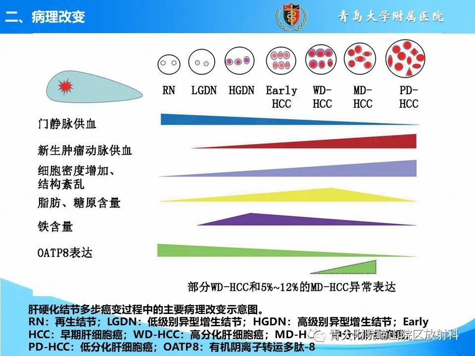影像PPT - 【PPT】肝细胞癌的影像学诊断与鉴别诊断-4