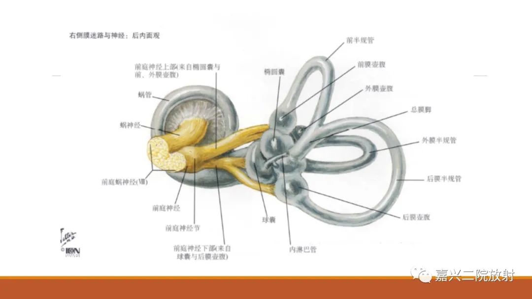 影像PPT - 【PPT】迷路炎的影像学诊断-4