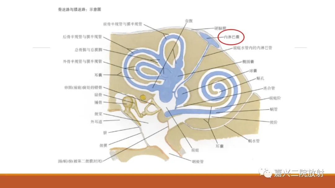 影像PPT - 【PPT】迷路炎的影像学诊断-5