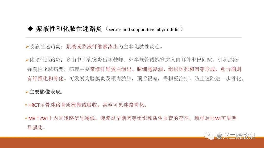 影像PPT - 【PPT】迷路炎的影像学诊断-13