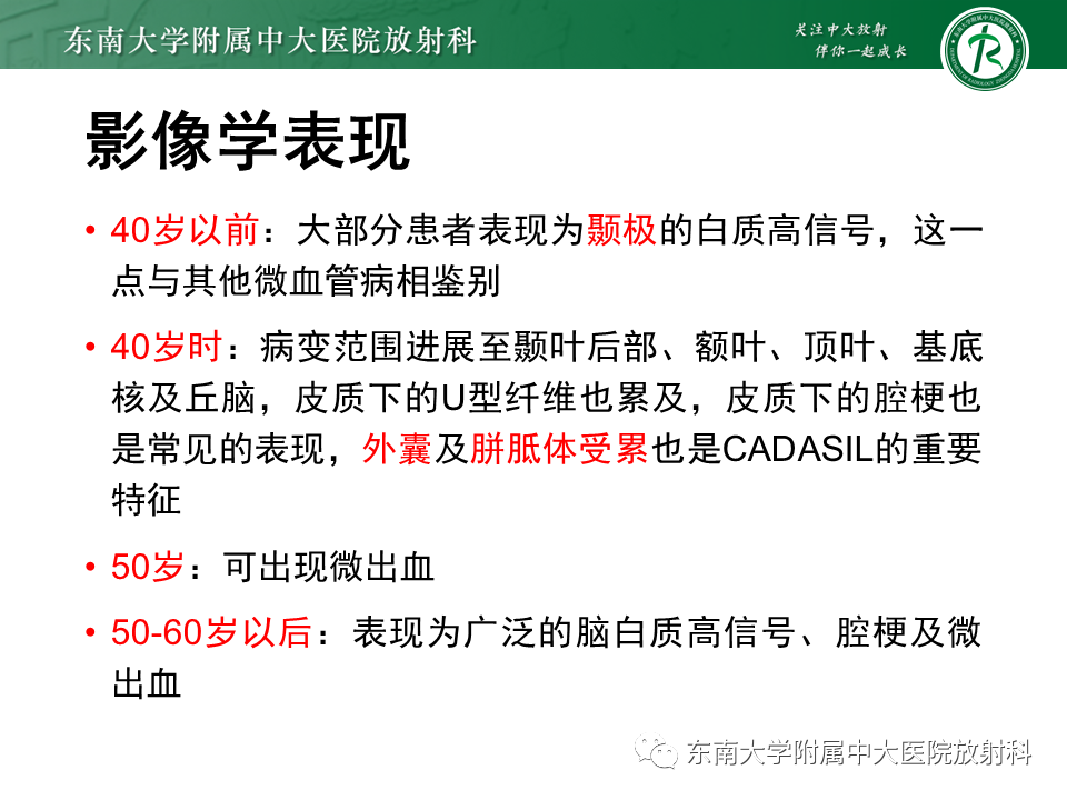 影像PPT - 【病例】急性播散性脑脊髓炎1例MR影像-28 影像PPT - 【病例】急性播散性脑脊髓炎1例MR影像-28