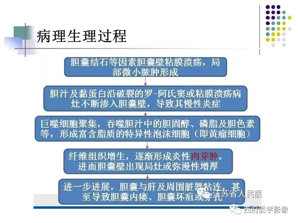 影像PPT - 【PPT】黄色肉芽肿性胆囊炎的影像诊断-9