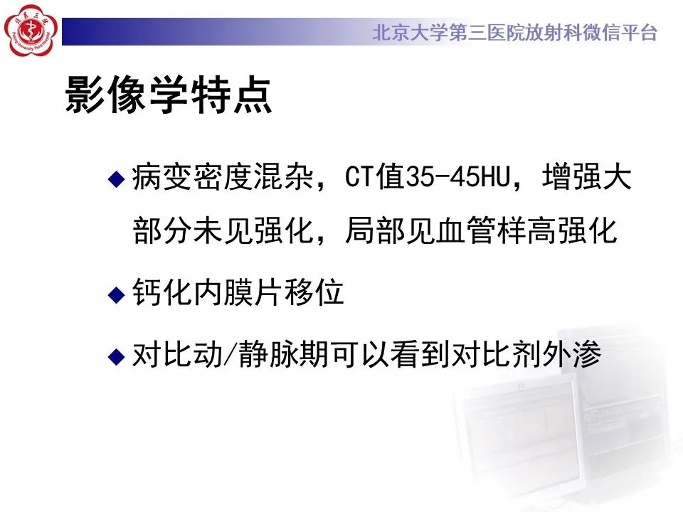 影像PPT - 【病例】慢性包裹性腹主动脉瘤破裂1例CT影像-15