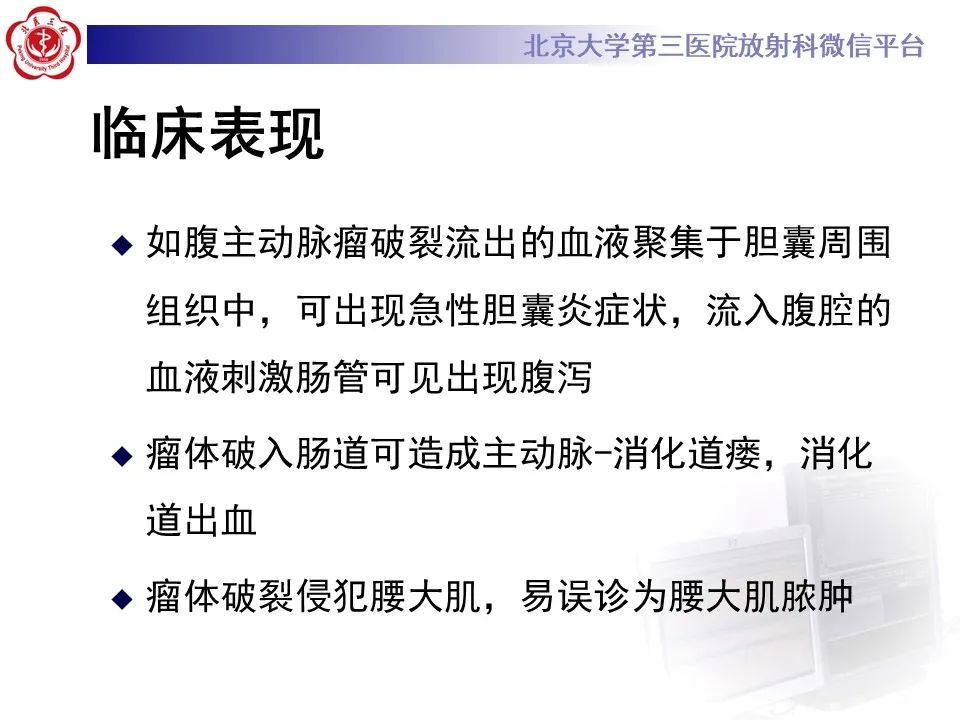 影像PPT - 【病例】慢性包裹性腹主动脉瘤破裂1例CT影像-22