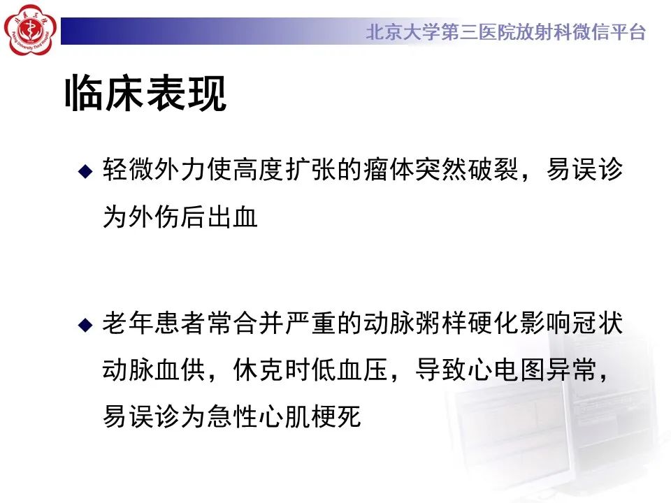 影像PPT - 【病例】慢性包裹性腹主动脉瘤破裂1例CT影像-25