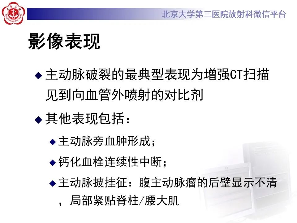 影像PPT - 【病例】慢性包裹性腹主动脉瘤破裂1例CT影像-26