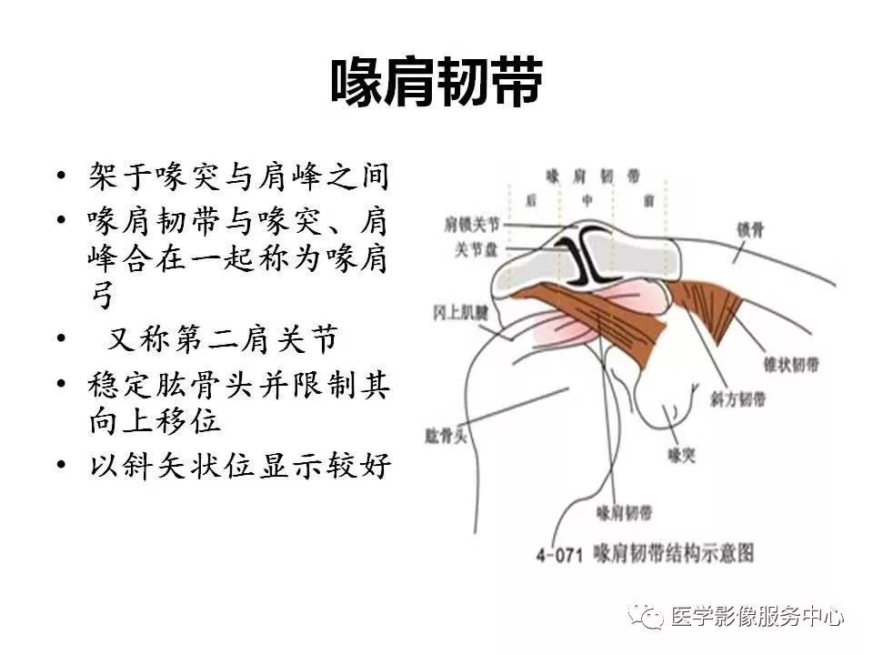 影像PPT - 【PPT】肩关节韧带及损伤的MR表现-13