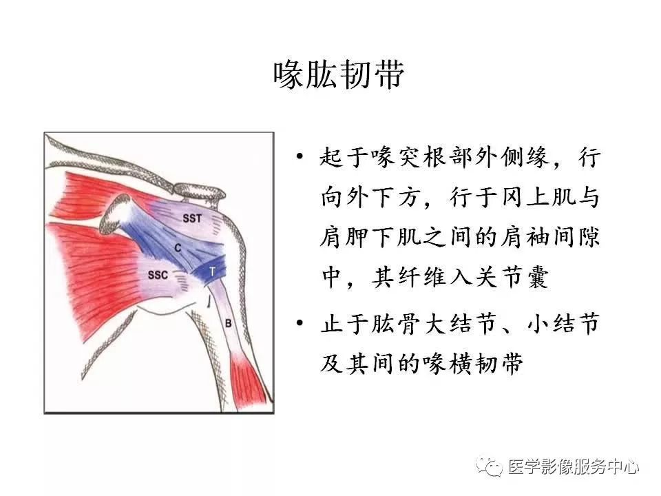 影像PPT - 【PPT】肩关节韧带及损伤的MR表现-24