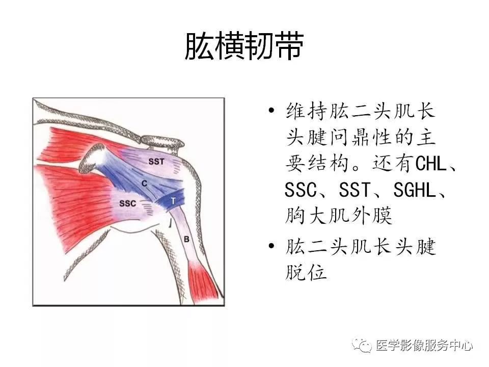 影像PPT - 【PPT】肩关节韧带及损伤的MR表现-31