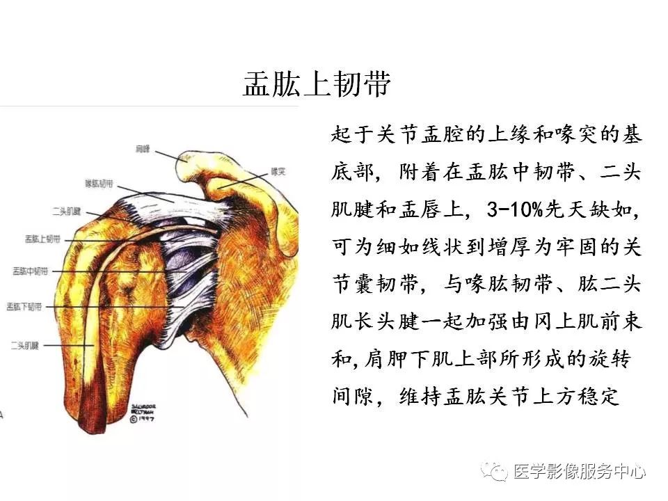 影像PPT - 【PPT】肩关节韧带及损伤的MR表现-45