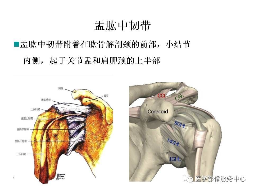 影像PPT - 【PPT】肩关节韧带及损伤的MR表现-59