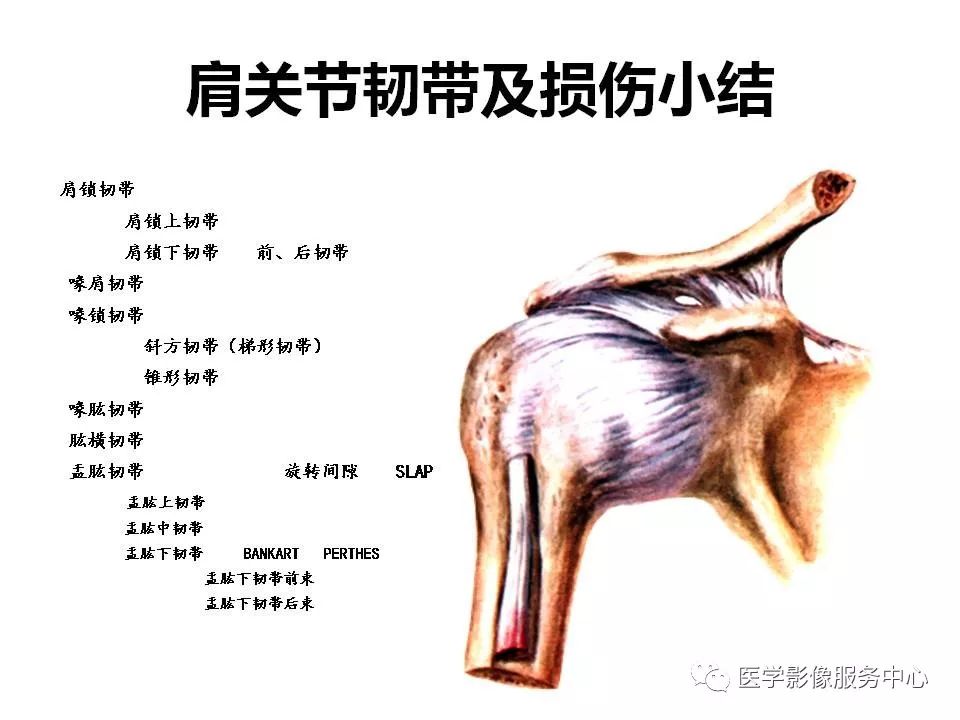影像PPT - 【PPT】肩关节韧带及损伤的MR表现-75