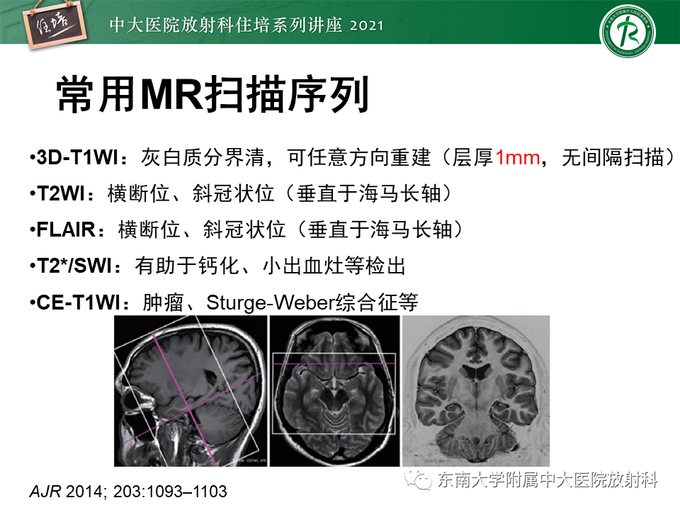 影像PPT - 【PPT】癫痫MR成像与常见疾病-8