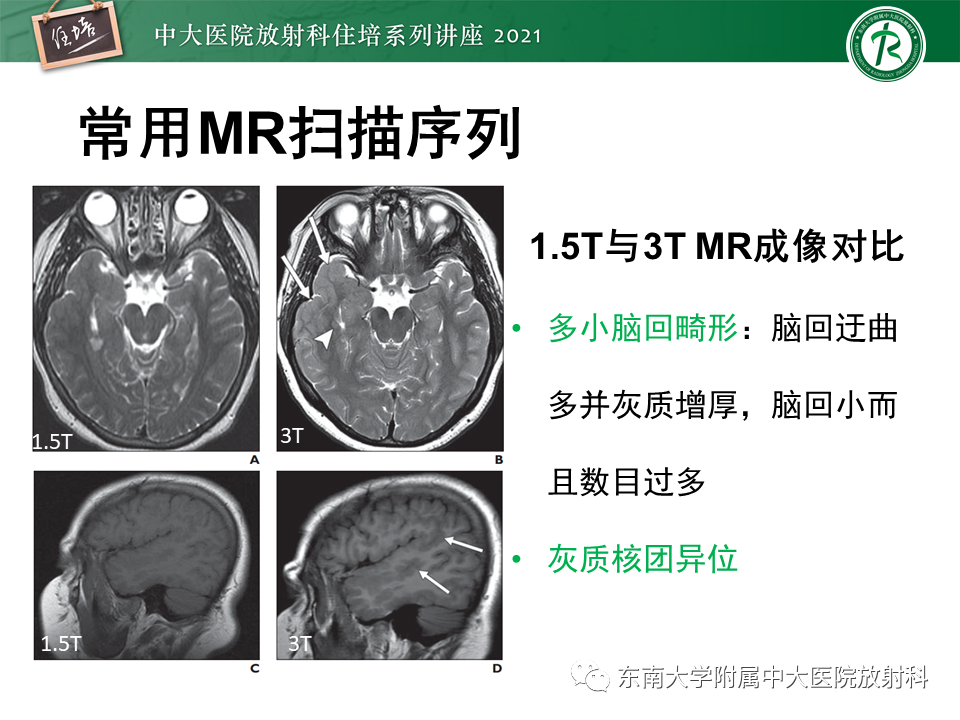 影像PPT - 【PPT】癫痫MR成像与常见疾病-9