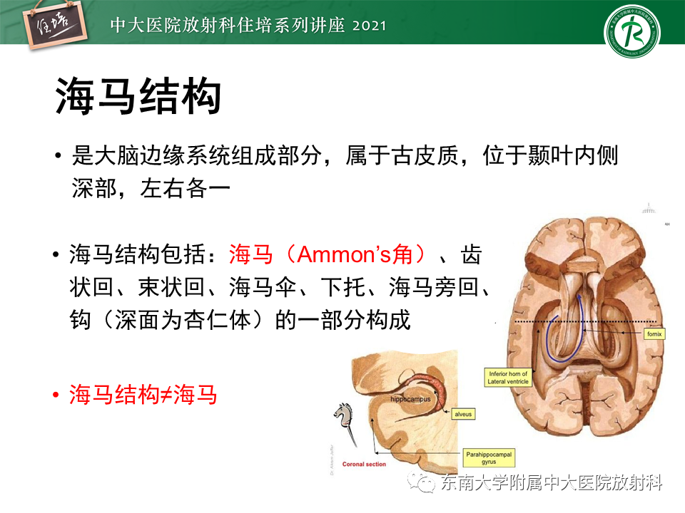 影像PPT - 【PPT】癫痫MR成像与常见疾病-13