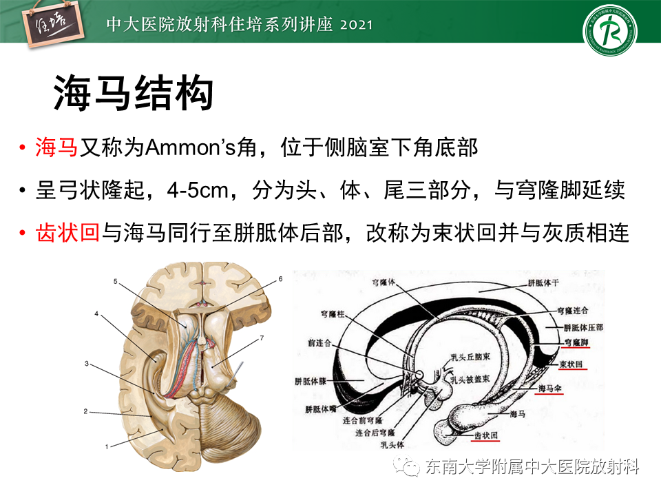 影像PPT - 【PPT】癫痫MR成像与常见疾病-14