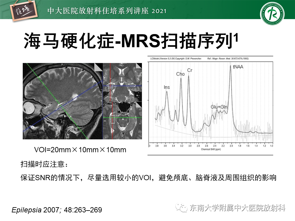 影像PPT - 【PPT】癫痫MR成像与常见疾病-24