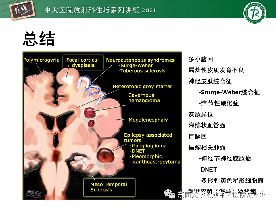 影像PPT - 【PPT】癫痫MR成像与常见疾病-55
