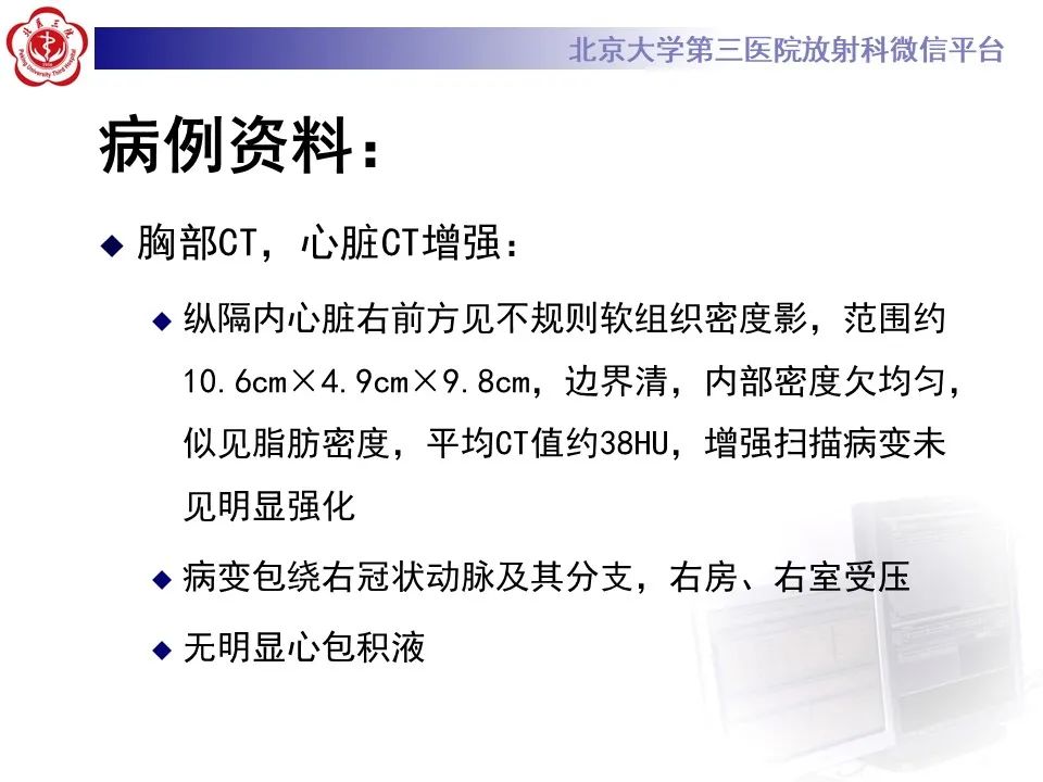影像PPT - 【病例】心包内脉管畸形1例CT及MR影像-4