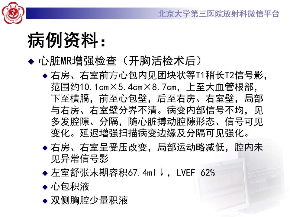 影像PPT - 【病例】心包内脉管畸形1例CT及MR影像-9