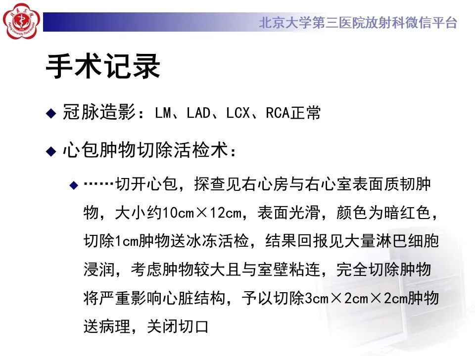 影像PPT - 【病例】心包内脉管畸形1例CT及MR影像-12