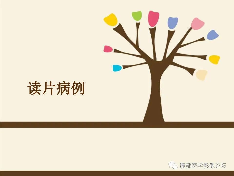 影像PPT - 【病例】胰腺平滑肌肉瘤1例CT影像诊断-1 影像PPT - 【病例】胰腺平滑肌肉瘤1例CT影像诊断-1